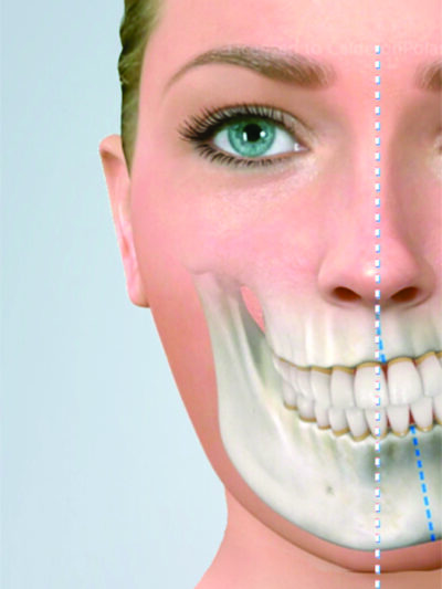 CIRUJANOS MAXILOFACIAL